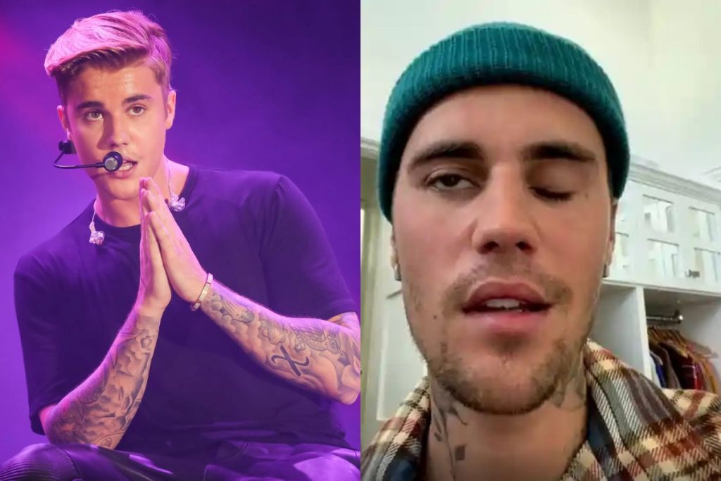 Justin Bieber facial paralysis