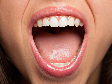 Graphic image of oral or mouth